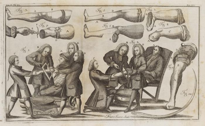 Institutiones chirurgicae in quibus quicquid ad rem chirurgicam pertinet optima et novissima ratione pertractatur. 4 Bde.