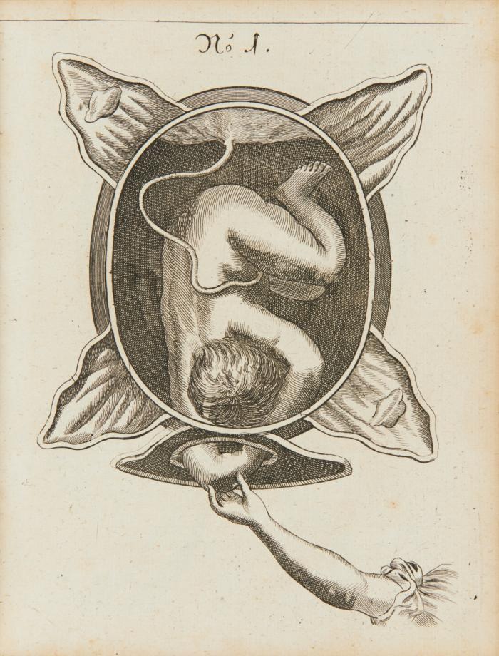 Die Königl. Preußische und Chur-Brandenburgische Hof-Wehe-Mutter, d. i. ... Untericht von schweren und unrechtstehenden Geburthen. 2 Tle. in 1 Bd.