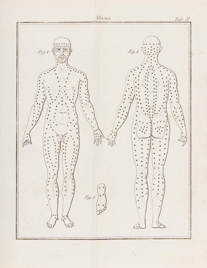 Medizinisch-chirurgische Abhandlungen zugleich als Nachtrag zu dessen medizinisch-chirurgischen Denkwürdigkeiten. Für deutsche Aerzte und Wundärzte. Aus dem französischen übersetzt v. Heinrich Robbi.