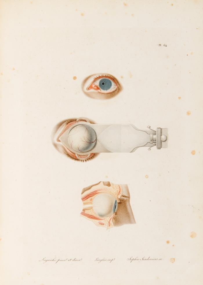 Traité des maladies des yeux, avec des planches coloriées représentant ces maladies d'après nature. Band IV.