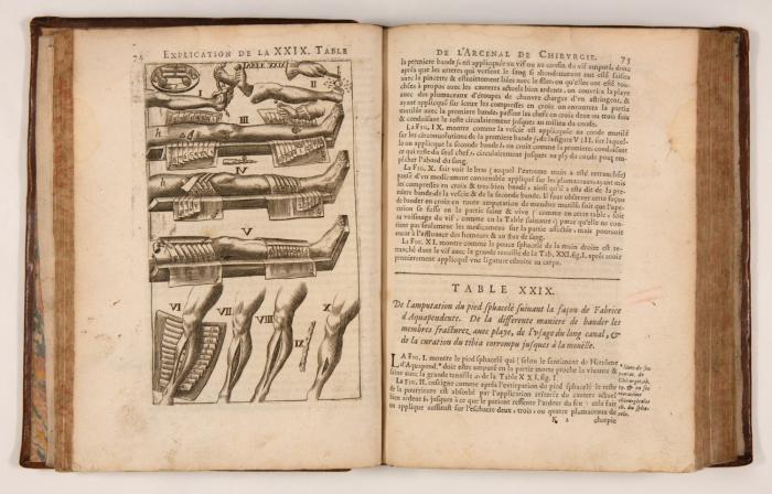 L'arcenal de chirurgie. Ouvrage postume ... Renouvellé, corr. et augm. Mis en françois par F. Deboze. ... avec la description d'un monstre humain exposé à Lyon le 5. de Mars 1671.  2 Tle. in 1 Bd.